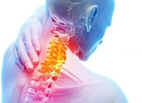 Pain and shelters in the cervical zone with the third degree of osteochondrosis